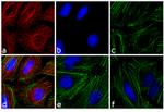 Mouse IgG Fc Cross-Adsorbed Secondary Antibody in Immunocytochemistry (ICC/IF)