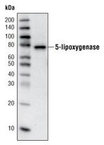 ALOX5 Antibody in Western Blot (WB)