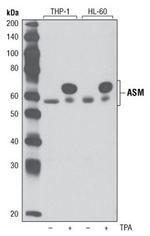 ASM Antibody in Western Blot (WB)