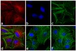 Rat IgG (H+L) Secondary Antibody in Immunocytochemistry (ICC/IF)