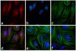 Mouse IgG (H+L) Cross-Adsorbed Secondary Antibody in Immunocytochemistry (ICC/IF)