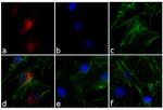 Rabbit IgG (H+L) Secondary Antibody in Immunocytochemistry (ICC/IF)