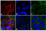 Rabbit IgG (H+L) Cross-Adsorbed Secondary Antibody in Immunocytochemistry (ICC/IF)