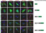 Golgin-97 Antibody in Immunocytochemistry (ICC/IF)