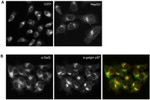 Golgin-97 Antibody in Immunocytochemistry (ICC/IF)