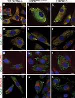 Golgin-97 Antibody in Immunocytochemistry (ICC/IF)