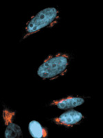 Golgin-97 Antibody in Immunocytochemistry (ICC/IF)