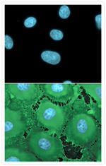 Nitrotyrosine Antibody in Immunocytochemistry (ICC/IF)