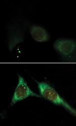 Phosphatidylinositol 3,4,5-trisphosphate Antibody in Immunocytochemistry (ICC/IF)