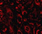 HSDL2 Antibody in Immunocytochemistry (ICC/IF)