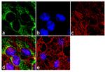 SOD2 Antibody in Immunocytochemistry (ICC/IF)