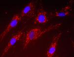 SOD2 Antibody in Immunocytochemistry (ICC/IF)