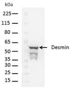 Rabbit IgG (H+L) Cross-Adsorbed Secondary Antibody in Western Blot (WB)