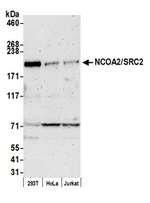 NCOA2/SRC2 Antibody in Western Blot (WB)