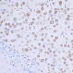 USP7 Antibody in Immunohistochemistry (Paraffin) (IHC (P))