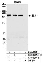 BLM Antibody in Immunoprecipitation (IP)