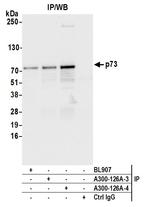 p73 Antibody in Immunoprecipitation (IP)