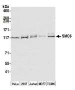 SMC6 Antibody in Western Blot (WB)