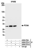 PCNA Antibody in Immunoprecipitation (IP)