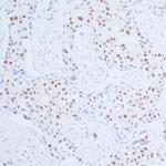 Rad6 Antibody in Immunohistochemistry (Paraffin) (IHC (P))