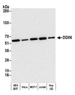 DDX6 Antibody in Western Blot (WB)