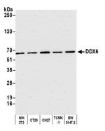 DDX6 Antibody in Western Blot (WB)