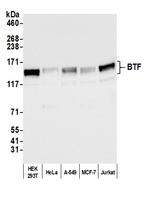 BTF Antibody in Western Blot (WB)