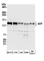 BTF Antibody in Western Blot (WB)