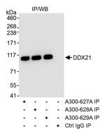 DDX21 Antibody in Immunoprecipitation (IP)