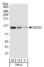 DDX21 Antibody in Western Blot (WB)