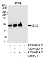 DDX21 Antibody in Immunoprecipitation (IP)
