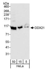 DDX21 Antibody in Western Blot (WB)