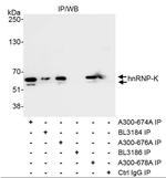 hnRNP-K Antibody in Immunoprecipitation (IP)