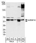 hnRNP-K Antibody in Western Blot (WB)