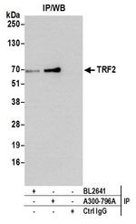 TRF2 Antibody in Immunoprecipitation (IP)