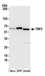 TRF2 Antibody in Western Blot (WB)