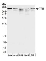 TPR Antibody in Western Blot (WB)