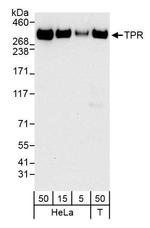 TPR Antibody in Western Blot (WB)