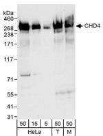 CHD4/Mi2 beta Antibody in Western Blot (WB)