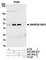 SMARCB1/SNF5 Antibody in Immunoprecipitation (IP)