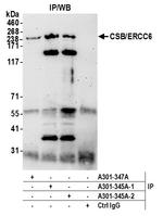 CSB/ERCC6 Antibody in Immunoprecipitation (IP)