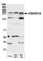 CSB/ERCC6 Antibody in Western Blot (WB)
