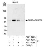 FKBP4/FKBP52 Antibody in Immunoprecipitation (IP)