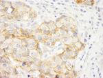 KIAA0528 Antibody in Immunohistochemistry (Paraffin) (IHC (P))