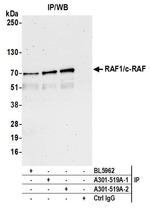 RAF1/c-RAF Antibody in Immunoprecipitation (IP)