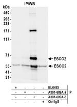 ESCO2 Antibody in Immunoprecipitation (IP)