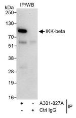 IKK-beta Antibody in Immunoprecipitation (IP)