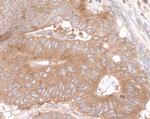 LARP1 Antibody in Immunohistochemistry (Paraffin) (IHC (P))