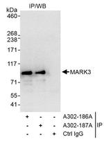 MARK3 Antibody in Immunoprecipitation (IP)