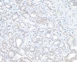 BAP1 Antibody in Immunohistochemistry (Paraffin) (IHC (P))